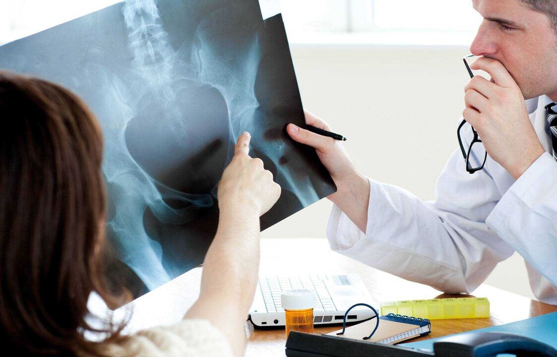 лекари који прегледају рендгенски снимак за артрозу кука