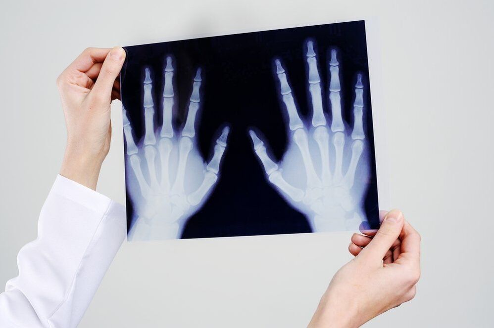 дијагностика зглобова руку